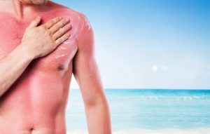 Penggunaan Sunscreen untuk Melindungi Kulit dari Paparan Sinar Matahari