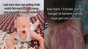 Viral Bayi Dikerok Pengasuh, Waspada Iritasi Pada Kulit Sensitif Si Kecil