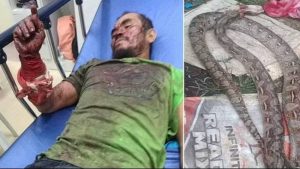 Pria Ini  Diserang Ular Piton Tapi Nekat Menggigit Balik Ular Tersebut