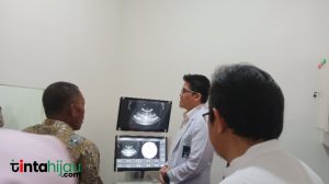 RSUD Subang Dilengkapi Alat Pemecah Batu Ginjal Tanpa Operasi