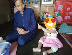 Balita Asal Sagalaherang Subang Menderita Scabies, Kondisi Badannya Kian Memprihatinkan