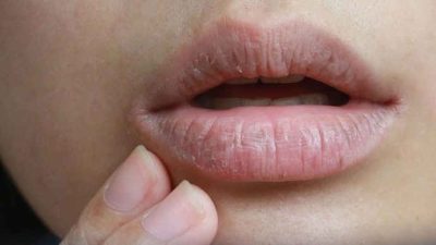 Tak Banyak yang Tahu, Faktor Ini Bisa Membuat Bibir Berubah Warna