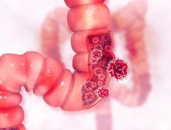 Ahli Gastroenterologi Ungkap Pola Makan Terbaik untuk Jaga Kesehatan Usus