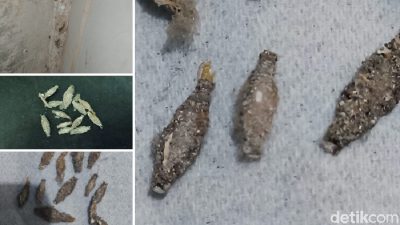 Mengenali Gejala Gatal Akibat Kamitetep