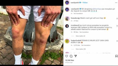 Kualitas Rumput SUGBK Dipertanyakan, Coach Justin Soroti Luka pada Lutut Thom Haye