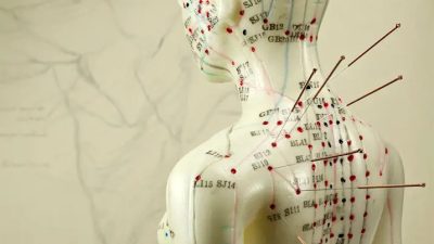 Mengenal TCM, Pengobatan Tradisional Tiongkok untuk Kecantikan