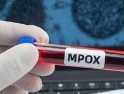 Pemerintah Siapkan Vaksin Tambahan untuk Hadapi Wabah Mpox