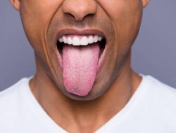 Waspadai Perubahan Warna Lidah Sebagai Indikator Kesehatan Tubuh