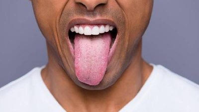 Waspadai Perubahan Warna Lidah Sebagai Indikator Kesehatan Tubuh