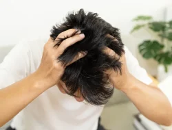 Ini Cara Agar Kulit Kepala Tidak Gatal