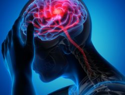 Jangan Salah Paham, Kenali Mistos yang Menyesatkan Soal Stroke