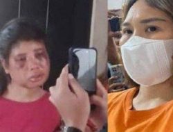 ART di Batam Diduga Dianiaya Majikan dan Rekannya, Polisi Tetapkan Dua Tersangka