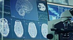 China Tanamkan Chip Otak dalam Uji Klinis Pertama, Pasien Mampu Kendalikan Perangkat dengan Pikiran
