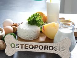 RSUD Subang Ajak Masyarakat Peduli Kesehatan Tulang, Cegah Osteoporosis Sejak Dini