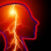 Mengenal Penyakit Epilepsi, Penyebab dan Gejalanya!