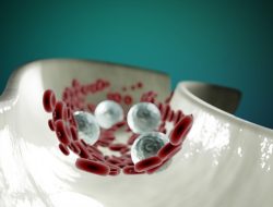 Yuk Kenali Penyakit PAD, Penyumbatan Pembuluh Darah Arteri!