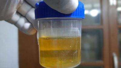 Ratusan ASN Sukabumi Jalani Tes Urine, Bupati dan Wakil Juga Turut Diperiksa