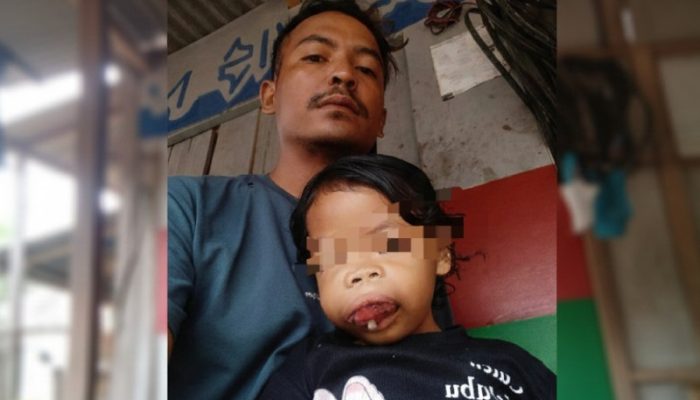 Terhimpit Biaya, Bocah 5 Tahun Asal Cibogo Subang Butuh Uluran Tangan untuk Berobat Leukemia