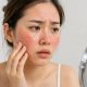 Berikut Kandungan Skincare yang Tidak Boleh Dipakai Bersamaan, Bisa Bikin Kulit Iritasi