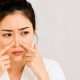 Cara Mengatasi Komedo Membandel di Hidung Tanpa Sakit, Kulit Bersih dengan Perawatan yang Tepat