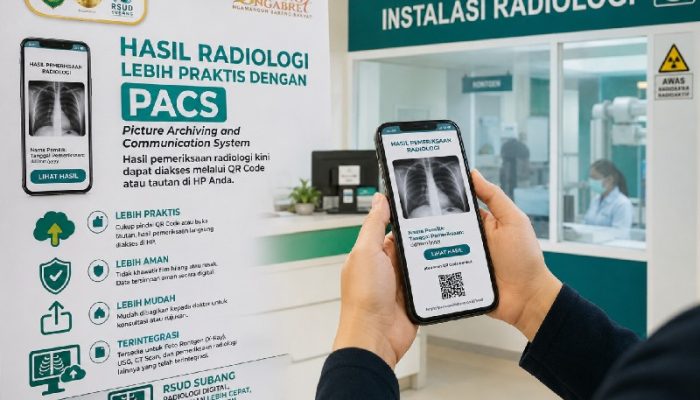 RSUD Subang Terapkan PACS, Pasien Tak Perlu Lagi Membawa Film Rontgen